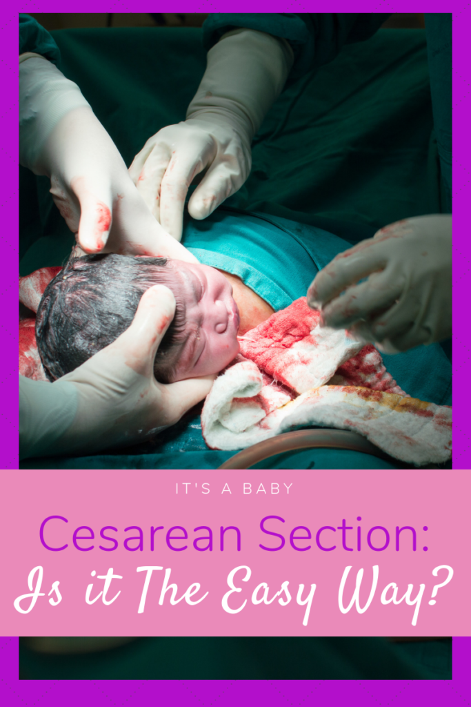 Cesarean Section: the easy way out